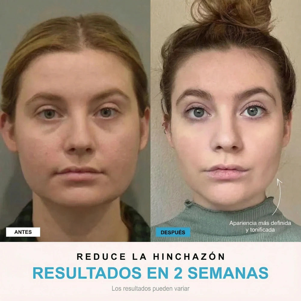 NivaLift | Dispositivo reafirmante facial + 1 SÉRUM DE REGALO
