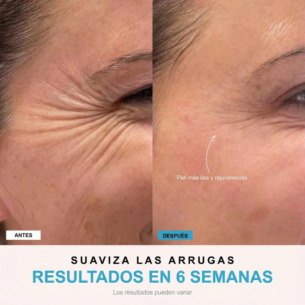 NivaLift | Dispositivo reafirmante facial + 1 SÉRUM DE REGALO