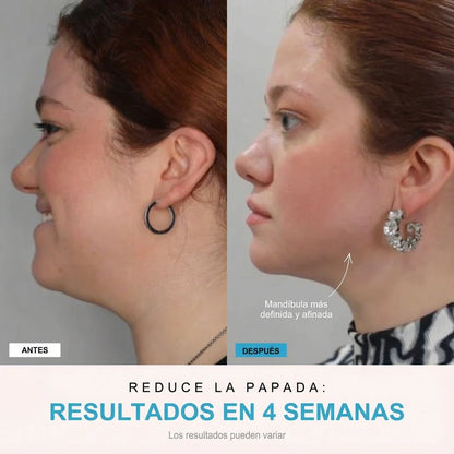 NivaLift | Dispositivo reafirmante facial + 1 SÉRUM DE REGALO